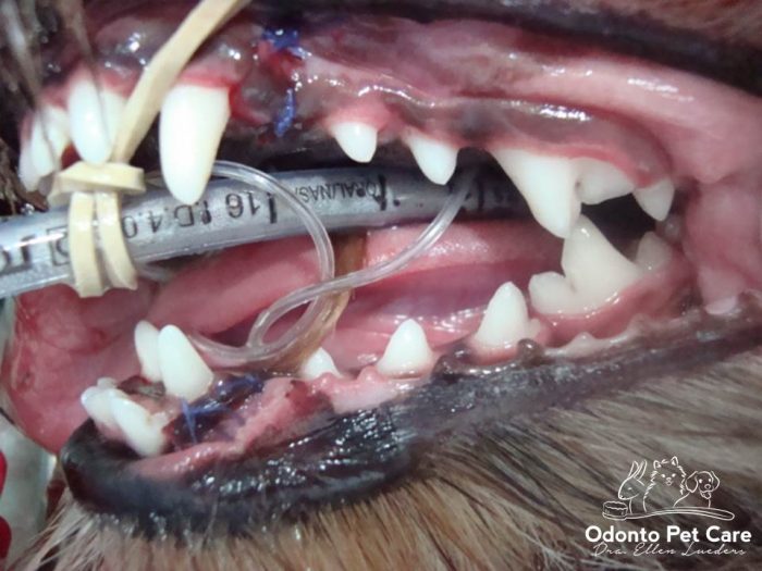 Depois - Profilaxia e exodontia dos caninos decíduos superior e inferior